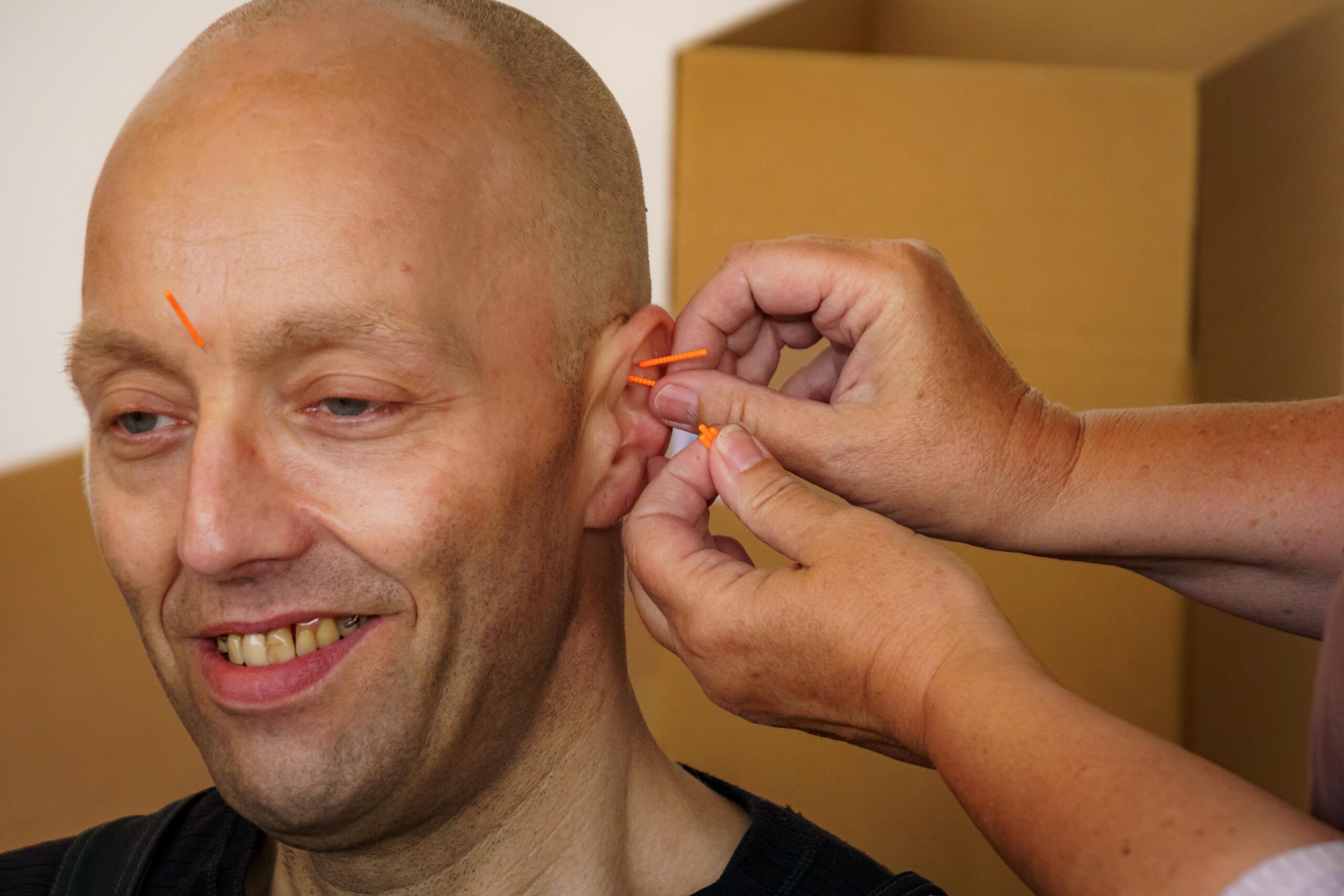 Borger får NADA behandling som en del af praktikforløbet hos Mina Group i Korsør.